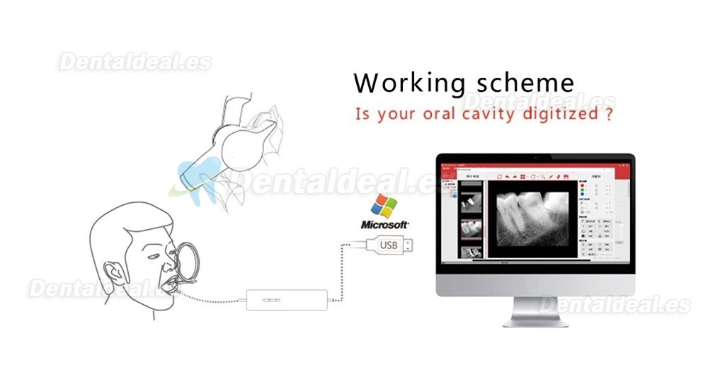 Runyes DR730 Sensor de rayos X digital dental Sistema de imagen de sensor intraoral